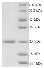(Tris-Glycine gel) Discontinuous SDS-PAGE (reduced) with 5% enrichment gel and 15% separation gel.